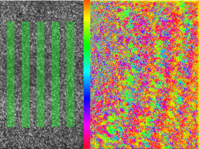 Fovea Images